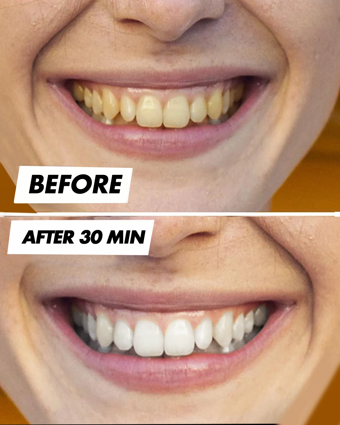 Teeth Whitening Strips - Image 5